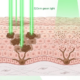 Green 520nm light modulating melanocyte activity and breaking up melanin clusters in the epidermis