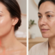 Close-up of smooth facial skin showing anti-aging and acne reduction benefits of red light